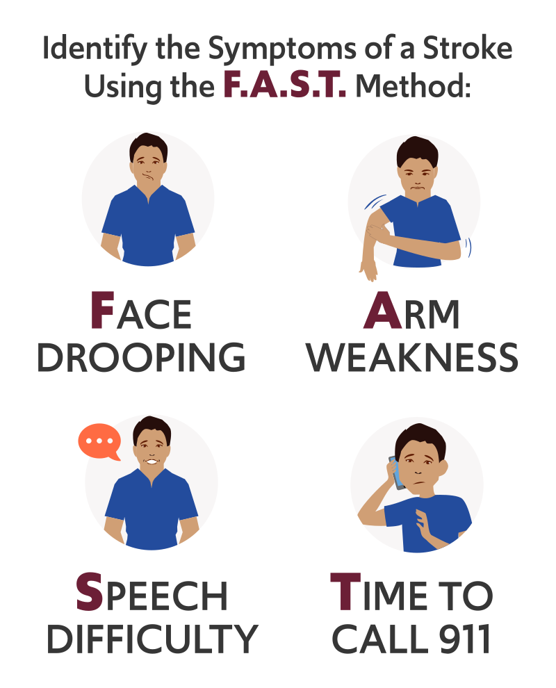 Illustration of Stroke