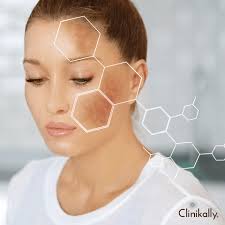 Illustration of Skin For Hyperpigmentation