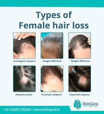 Illustration of TREATMENT OF HAIR LOSS